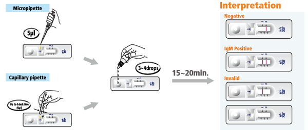 JEV-IgM_test-procedure(0)